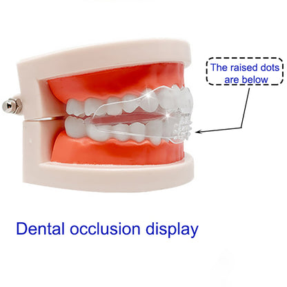 Cosmetic Braces