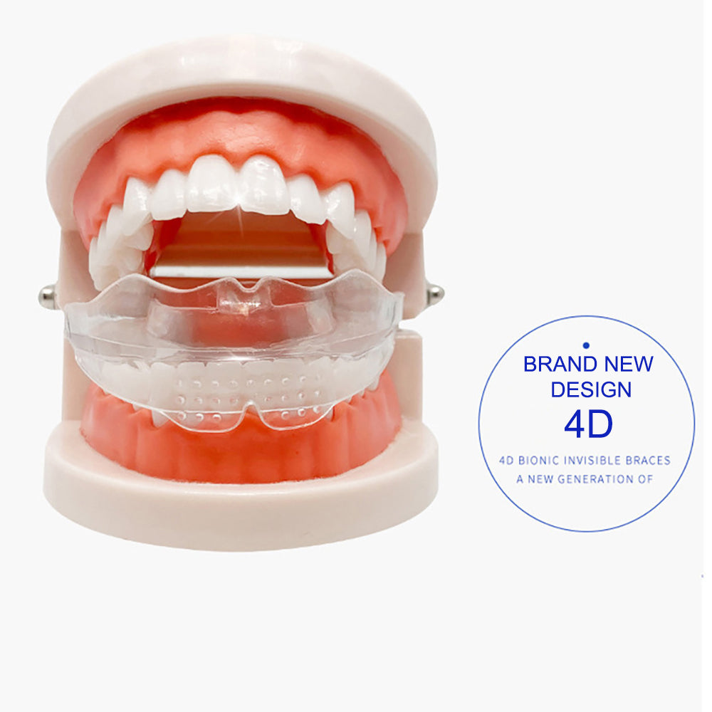 Cosmetic Braces
