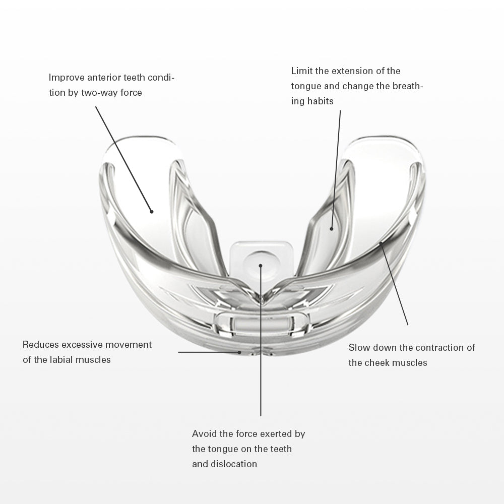 Cosmetic Braces