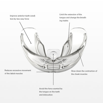 Cosmetic Braces