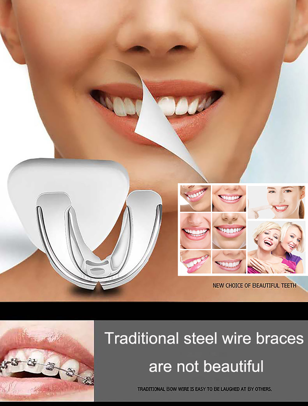 Cosmetic Braces